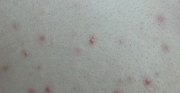 ݸԤë׸